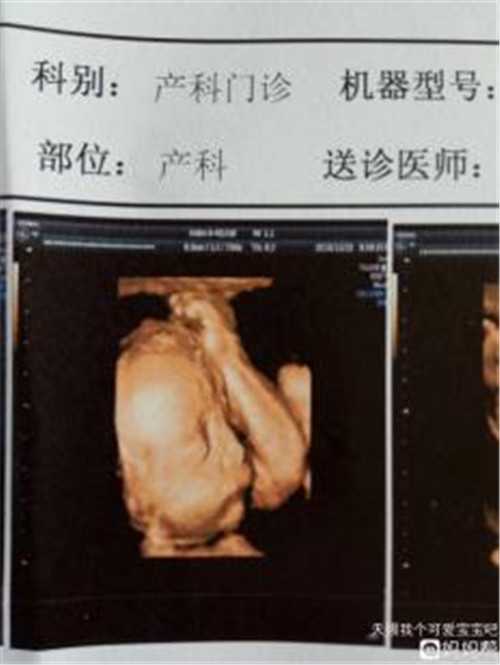 杭州正规代生小孩 2022年杭州供卵试管婴儿医院名单一览： ‘男孕囊和女孕囊的